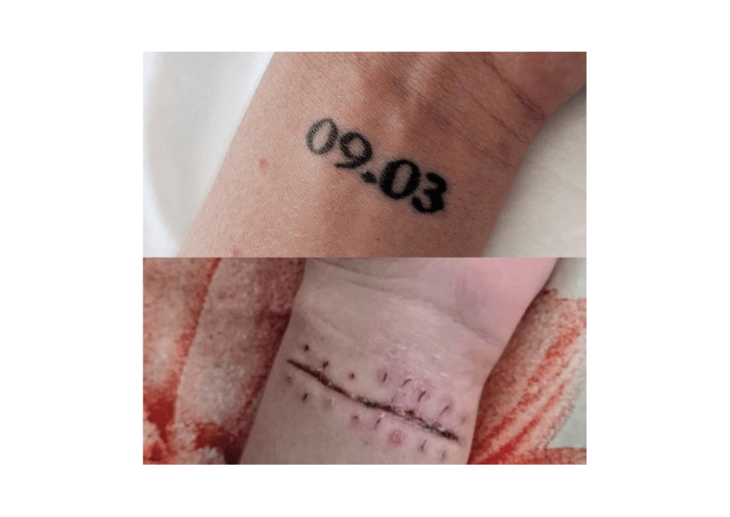 How to remove PMU in one&nbsp;session?