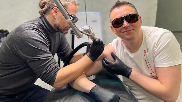 Dr. Vitaly Mikryukov's own tattoo, made and then laser-removed as a personal experiment